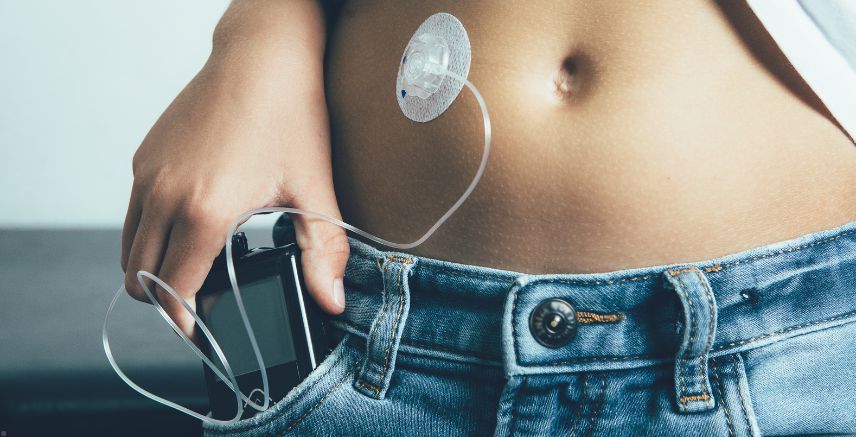 A close up of a woman putting an insulin pump in her pants pocket, with the patch showing on her stomach.