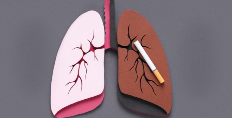 An illustration of lungs. One half is pink and healthy. The other half is brown and covered by a cigarette.